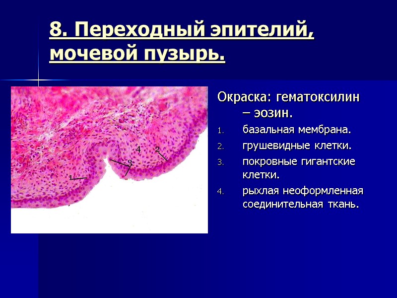 8. Переходный эпителий, мочевой пузырь.  Окраска: гематоксилин – эозин. базальная мембрана. грушевидные клетки.